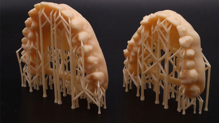 Печать протеза 3D-принтером : 3d принтер для стоматологии